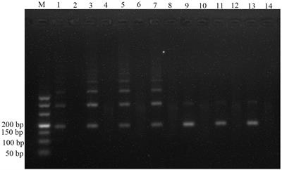 Rapid visual detection of anisakid nematodes using recombinase polymerase amplification and SYBR Green I